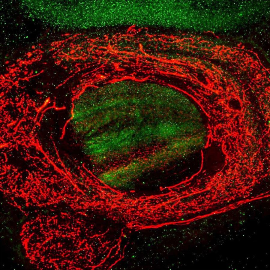 zur Vergrößerungsansicht des Bildes: Anti-Am5-HT1A- (grün) und Anti-Serotonin-Färbung (rot) im Gehirn der Honigbiene.