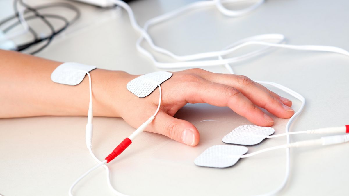 Foto von einer Hand, an der Messelektroden befestigt sind. 