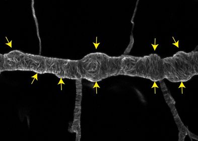 Lichtmikroskopische Aufnahme des Atemorgans eines Drosophila-Embryos. Die gelben Pfeile zeigen auf ungewöhnliche Ausbeulungen eines eigentlich glatten, röhrenförmigen Tracheenastes. Diese Ausbeulungen können nach kurzer Zeit einreißen und so die Funktion der Atemröhren zum Transport der Atemluft zerstören.