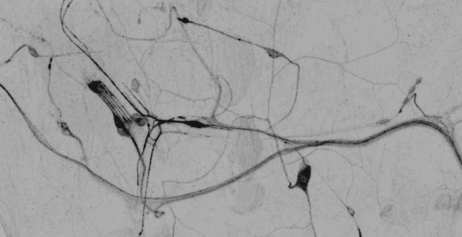 Confocal image of fluorescently labelled somatosensory neurons in Drosophila.