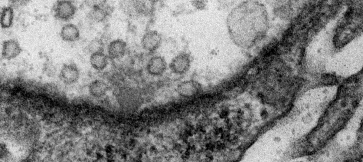 enlarge the image: Shown is an electron micrograph of an active zone T-bar in Drosophila.
