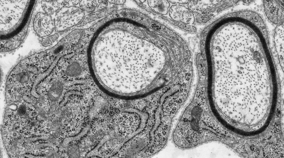 Electron micrograph of myelin wrapping