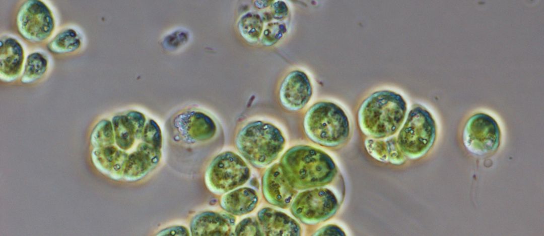 Grüne Zellen eines GMO Stamm von Chlamydomonas reinhartii (D5) unter dem Mikroskop.