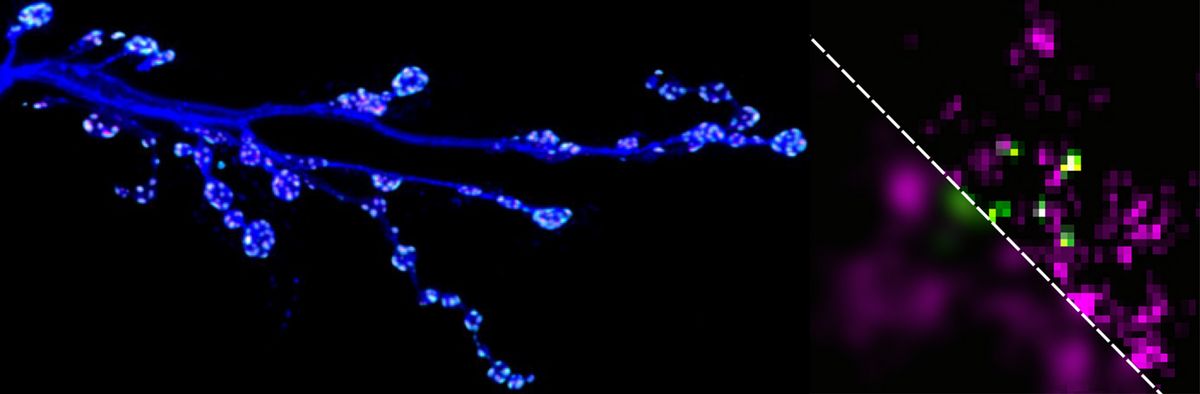 zur Vergrößerungsansicht des Bildes: Drosophila NMJ, konfokal und SRM