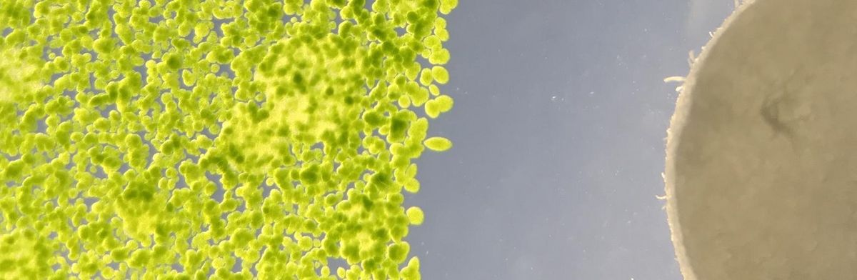 zur Vergrößerungsansicht des Bildes: Mikroskopisches Bild der Grünalgae Chlamydomonas reinhardtii mit einem Hemmhof durch Meatbolite eines Bakteriums.
